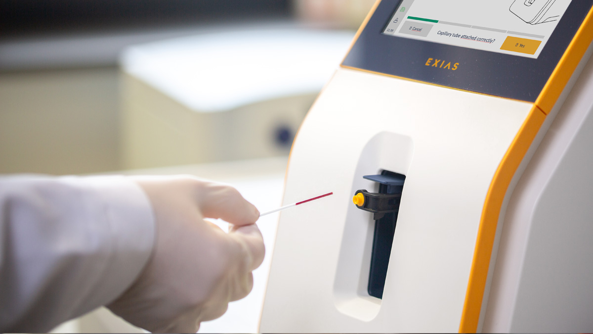 Käsineellinen käsi asettaa verinäyteputken lääketieteelliseen analyysikoneeseen, jossa on näyttöruutu.