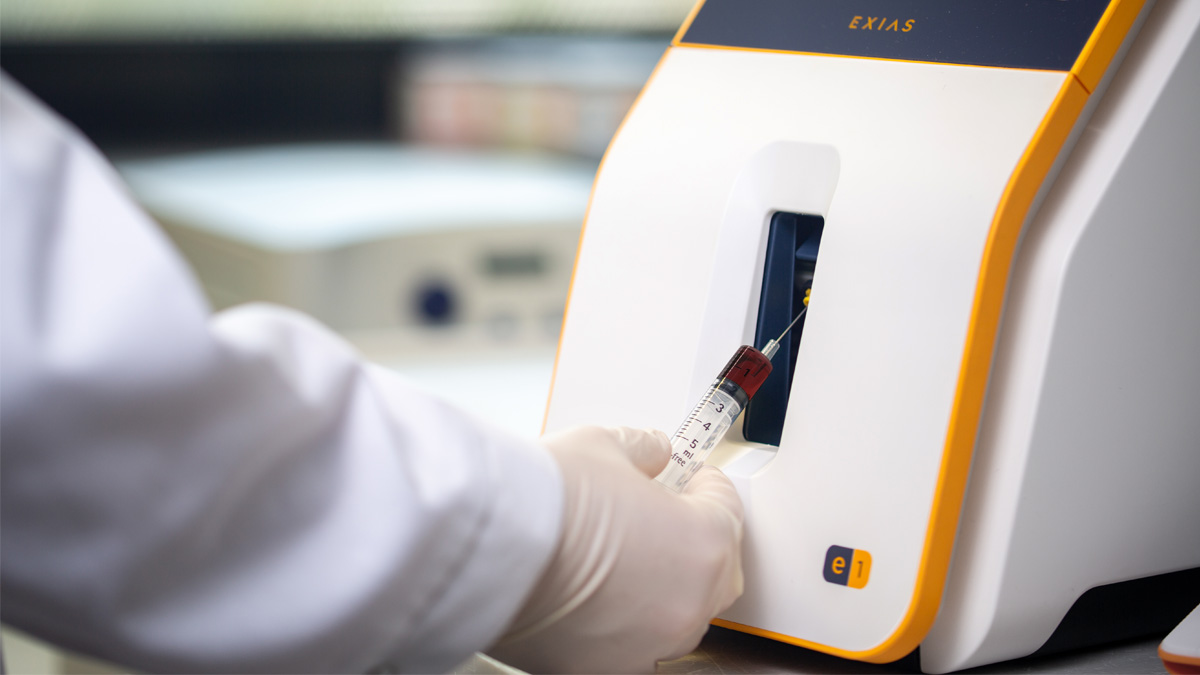 Käsineellinen käsi asettaa verinäyteampullin EXIAS-merkittyyn lääketieteelliseen analyysikoneeseen testiä varten.