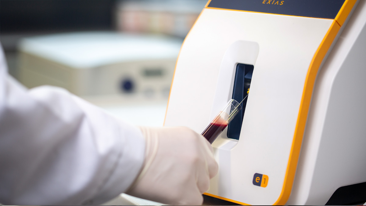 Käsineellä suojattu käsi asettaa verinäyteputken laboratoriolaitteeseen.