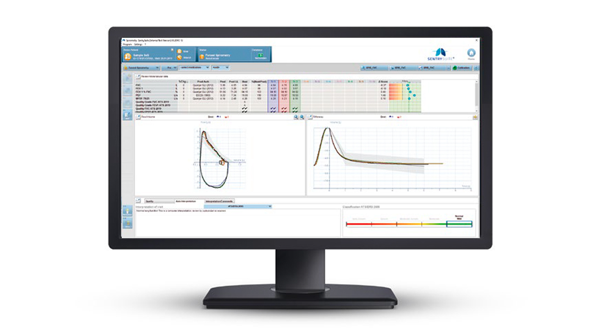 Tietokoneen näyttö näyttää spirometriatestin tulokset ja keuhkofunktiografiikat eri tietotaulukoineen.