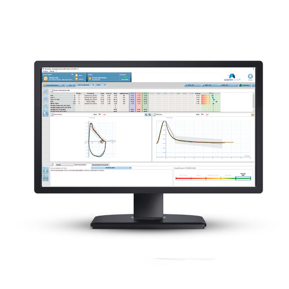 Tietokonenäyttö, jossa näkyy tieteellisen analyysin ohjelmisto erilaisine kaavioineen, graafeineen ja tietotauluineen näytöllä.