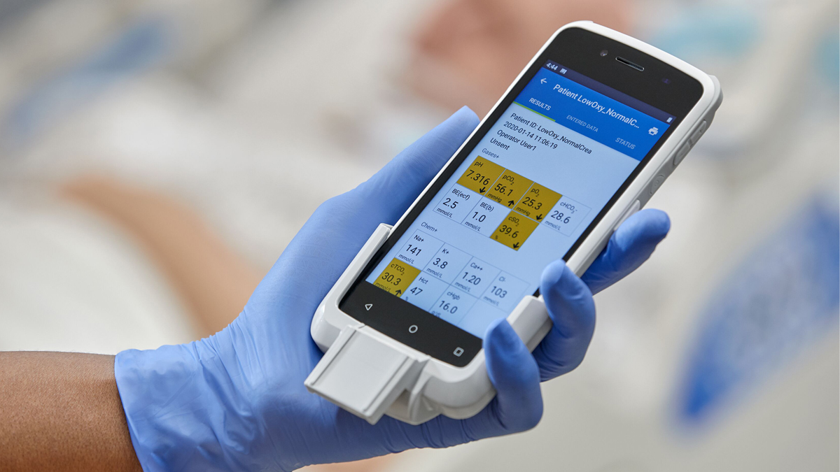 Käsi sinisessä hanskassa pitää lääketieteellistä laitetta, jonka näytöllä näkyy potilastietoja.