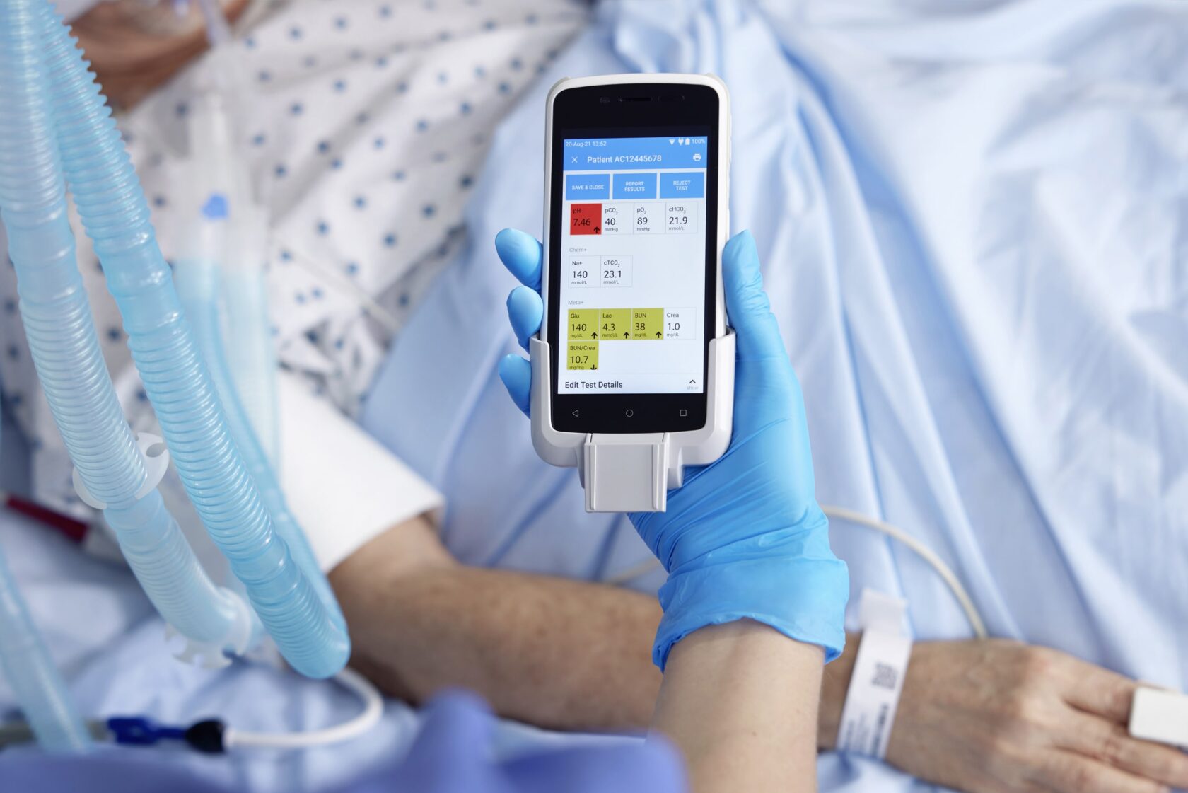 Hand med handskar håller en medicinsk enhet som visar patientens testresultat bredvid en patient i en sjukhussäng.