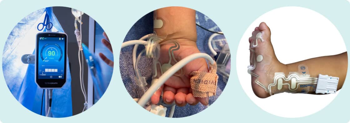 Tetragraph-monitori ja anturit käytössä kalibrointi- ja mittaustilanteissa kädessä ja jalassa.